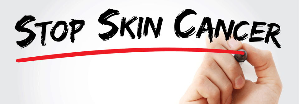 Der Begriff „Non-Melanoma Skin Cancer“ schließt neben Basalzellkarzinomen auch Plattenepithelkarzinome ein.