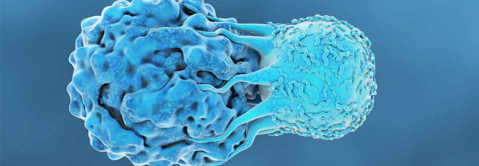 Um einen soliden Tumor zu bekämpfen, reicht das CAR-T-Zell-Produkt alleine wahrscheinlich nicht aus.