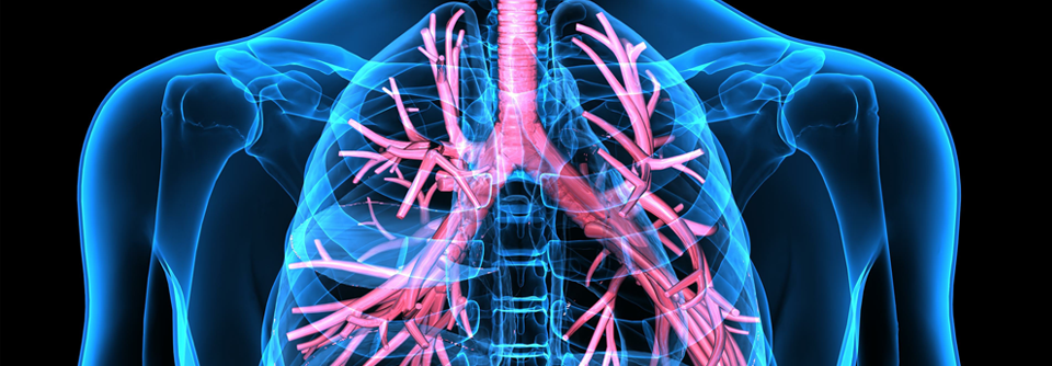 Schleimpfropfen in den Atemwegen prädestinieren für schwere Asthmaverläufe.