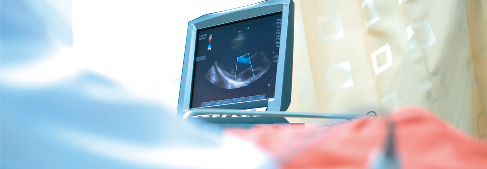 Mithilfe der Echokardiografie lassen sich typische Befunde wie linksventrikuläre Hypertrophie darstellen.