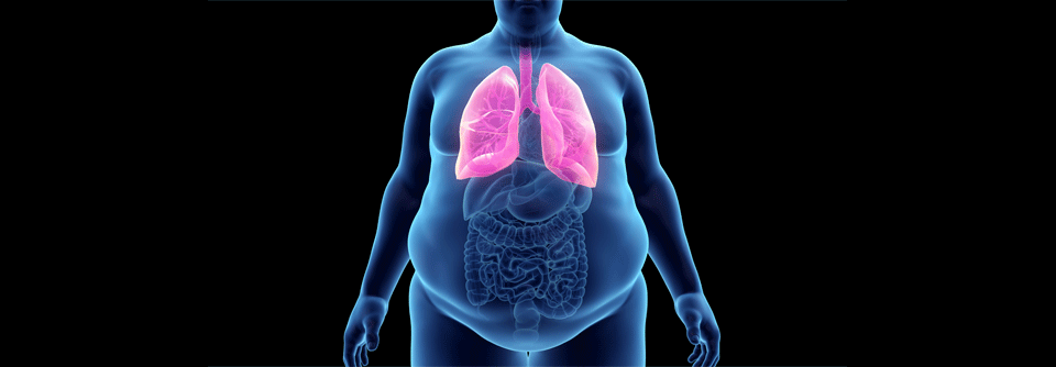 Wie im Falle anderer Erkrankungen stellt auch das Adipositas-Paradoxon bei Lungenkrebs vermutlich ein Artefakt dar.