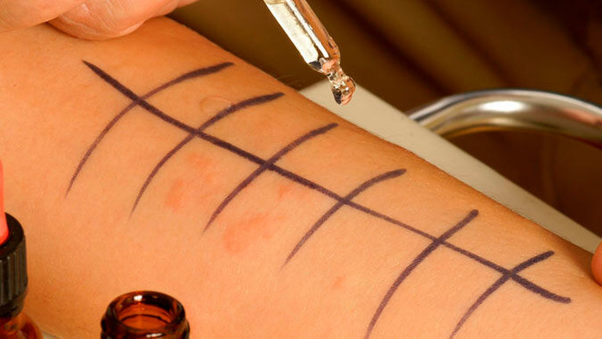 Allergologie – Aktuelles, Diagnostik & Therapie