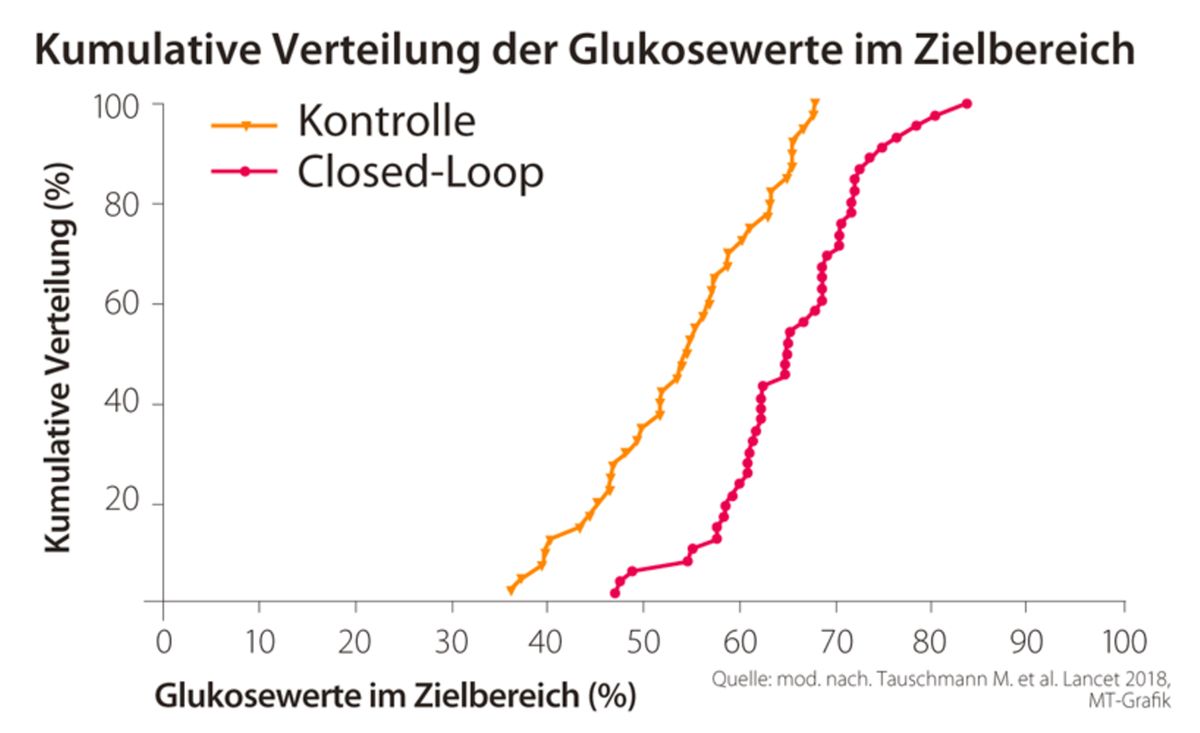 Studie untersucht Effekte eines hybriden Closed-Loop 