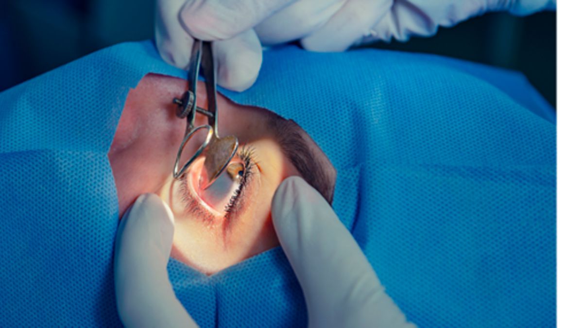 Welche Mglichkeiten die refraktive Chirurgie bietet