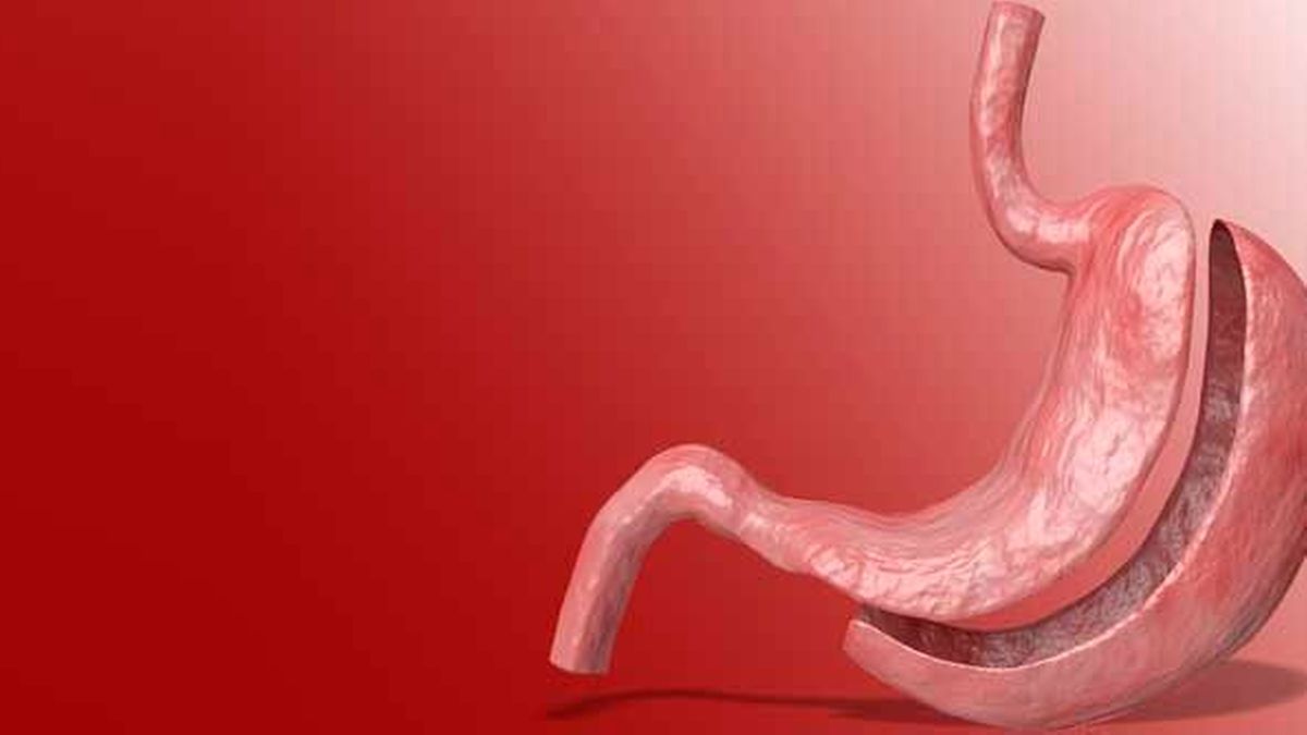 Adipositas: Endoskopisches Vorgehen ist sicher und effektiv