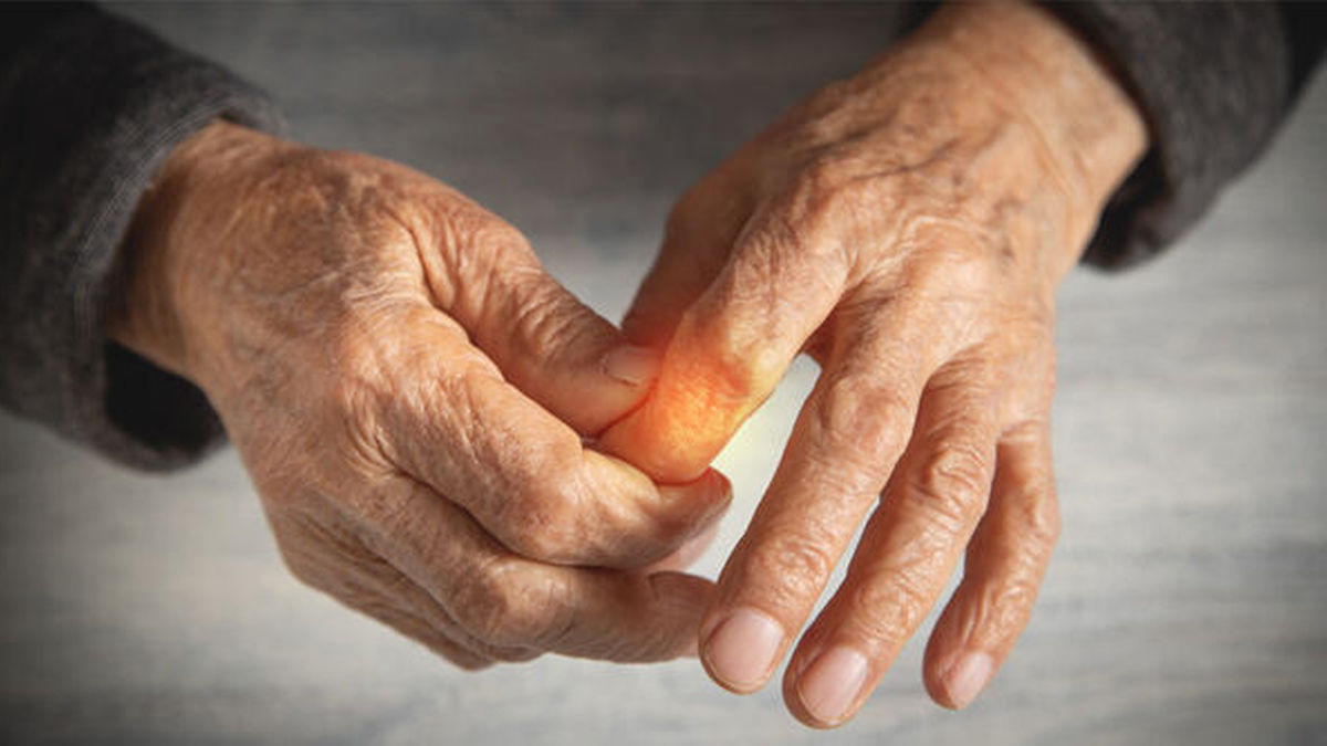 Arthritis oder Arthrose: Schmerzen in Finger- und Handgelenken auf der Spur