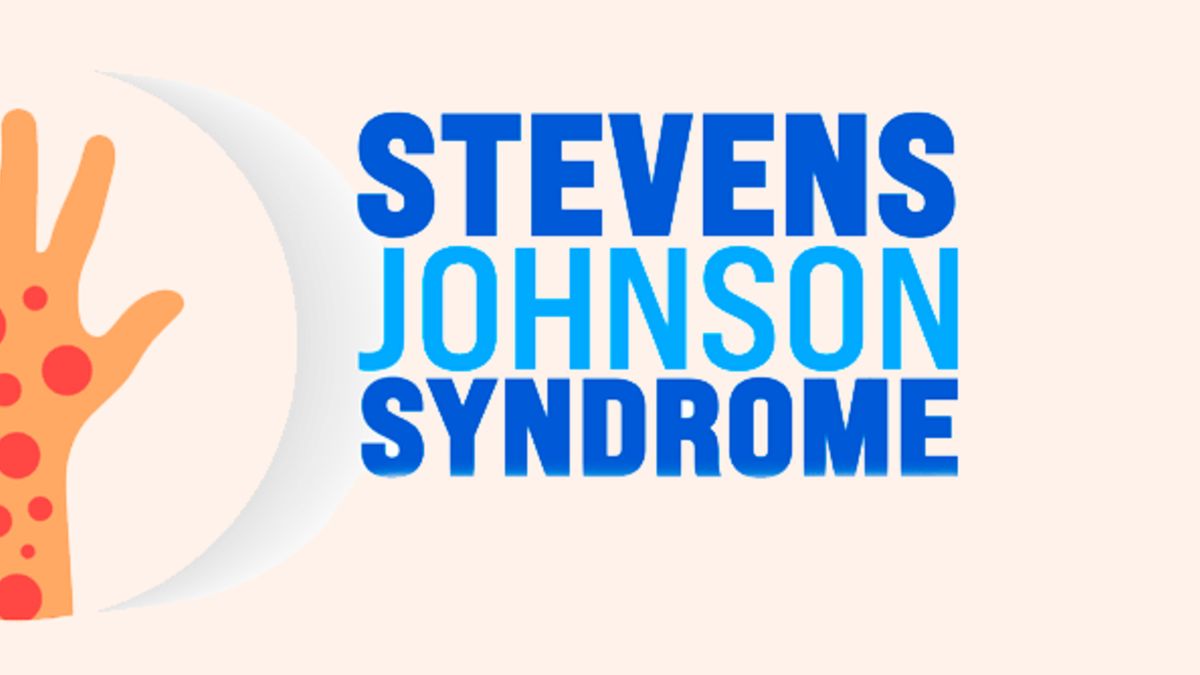 Stevens-Johnson-Syndrom: Wenn sich die Haut plötzlich ablöst