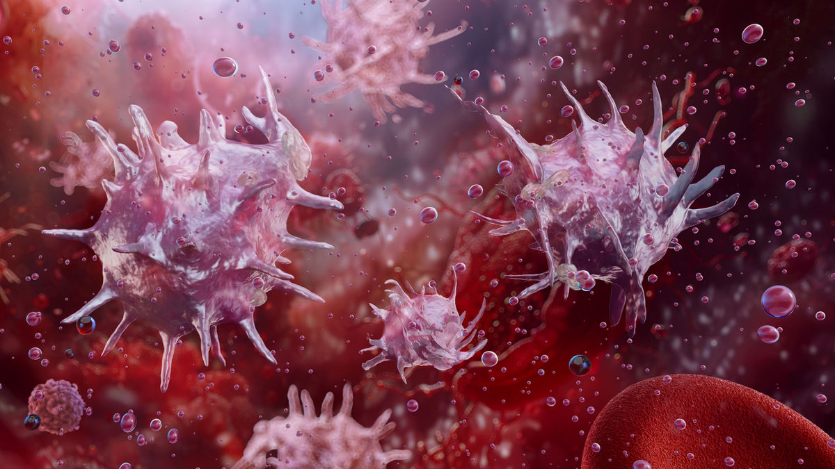 Mögliche Ursachen für eine Thromboytose