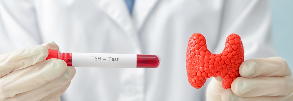 TSH-Bestimmung: Vor oder nach Thyroxin-Einnahme? Prinzipiell sollte die Blutabnahme zur Bestimmung der Schilddrüsenhormone und des basalen TSH immer vor Einnahme der Schilddrüsenmedikation erfolgen.