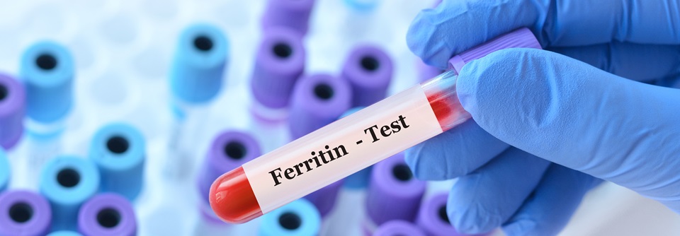 Eisenmangel: Mit und ohne Anämie behandeln! Serum-Ferritin ist ein Maß für die Beladung der Eisenspeicher.