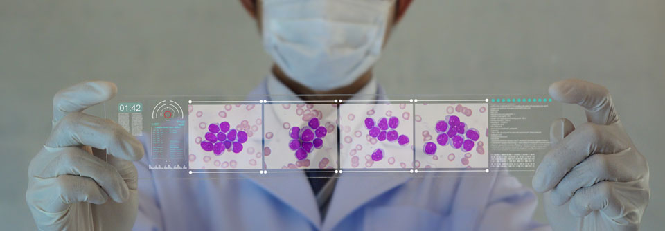 Die Ergebnisse zeigen, dass der STAMP-Inhibitor eine wichtige zukünftige Drittlinie der CML ist.