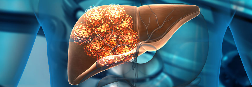 Bei Vorbehandelten zeigt Pembrolizumab ein günstiges Nutzen-Risiko-Profil.