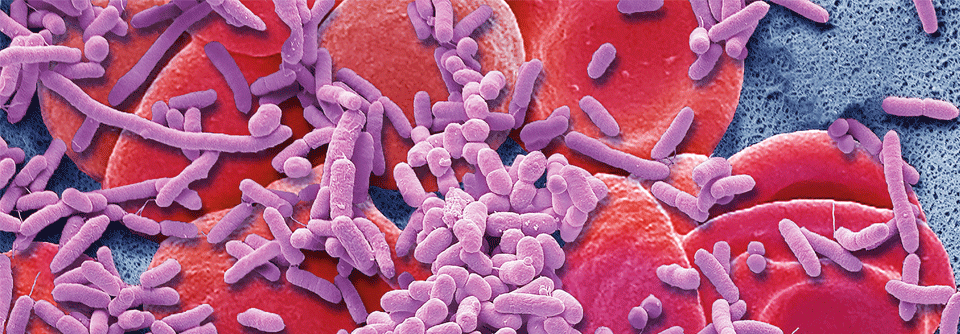 Breiten sich Bakterien über das Blut im gesamten Körper aus, droht eine Sepsis.
