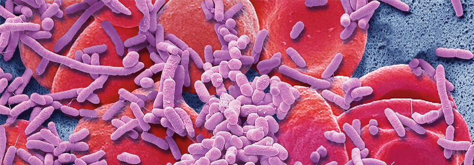 Sepsis: Kampagne soll Todesfälle vermeiden Breiten sich Bakterien über das Blut im gesamten Körper aus, droht eine Sepsis.