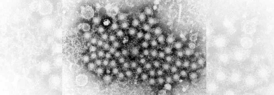 Nur etwa 10 % der mit Hepatitis-D-Viren Infizierten erreichen eine langfristige Heilung.
