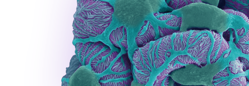 In der mikroskopischen Aufnahme eines Glomerulus sieht man, wie Podozyten die Kapillaren umarmen.