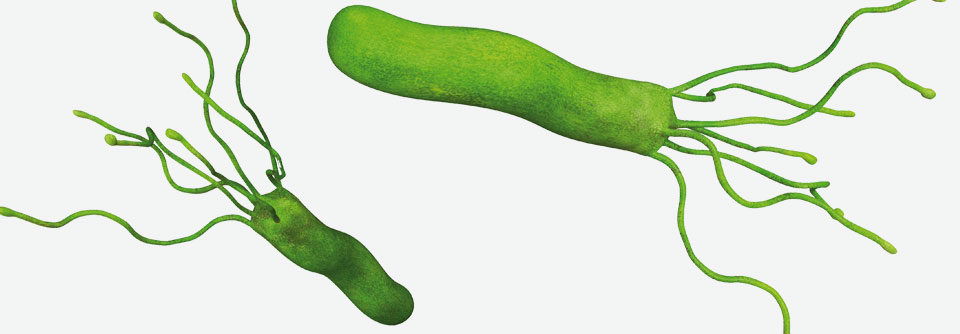 Helicobacter pylori: Was beim zufälligem Nachweis zu tun ist