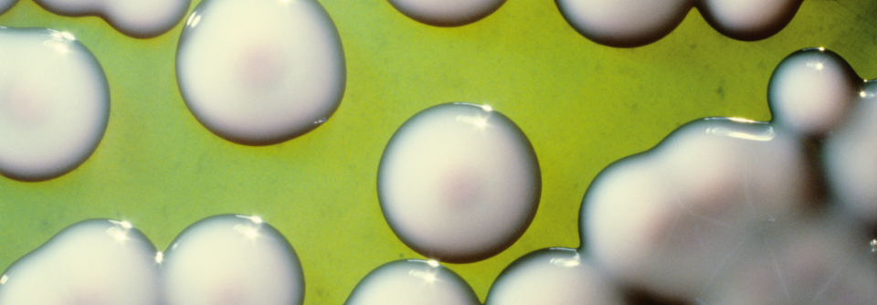 Schätzungen zufolge erkrankten im Jahr 2017 weltweit 10,9 Millionen Menschen an Typhus und 3,4 Millionen an Paratyphus.