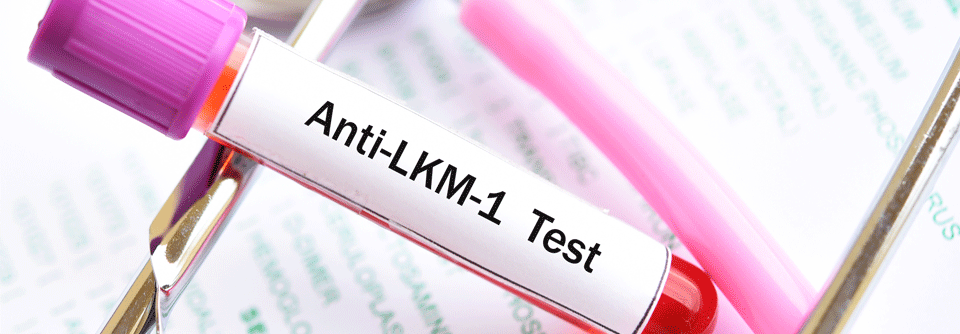 Autoimmunhepatitis: Langfristige Therapie und Kontrolle besonders wichtig