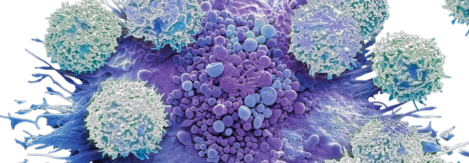 Ein Zytokinsturm unter dem Mikroskop: Um die Makrophage (Mitte) haben sich viele Lymphozyten gesammelt.