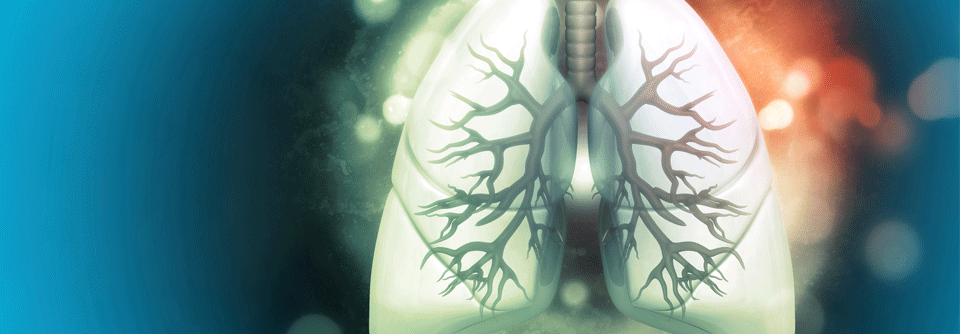 In der internationalen Studie BT10+ wurden Wirksamkeit und Sicherheit der bronchialen Thermoplasie bei Asthmatikern untersucht.