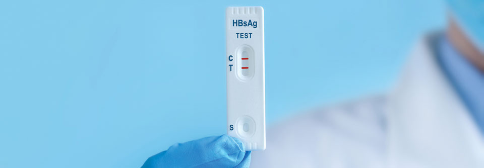 HBsAg-positive Patienten haben das höchste Risiko für eine reaktivierte HBV-Infektion.