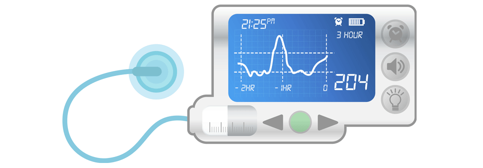 Neue, digitale Behandlungstechniken sind komplex – Patientenleitfäden können Diabetiker im alltäglichen Umgang damit unterstützen.