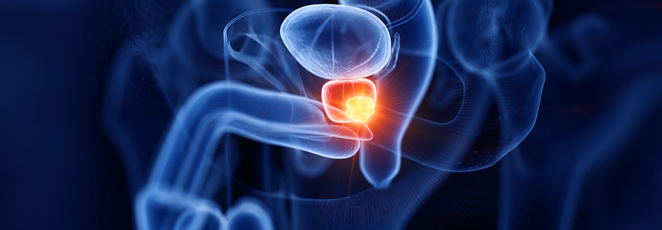 Die Triple-Therapie verlängert das radiographische progressionsfreie Überleben um zwei Jahre.