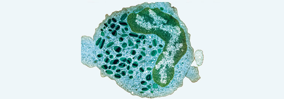 Mitunter halten eosinophile Granulozyten die Hörschnecke für einen Parasiten.