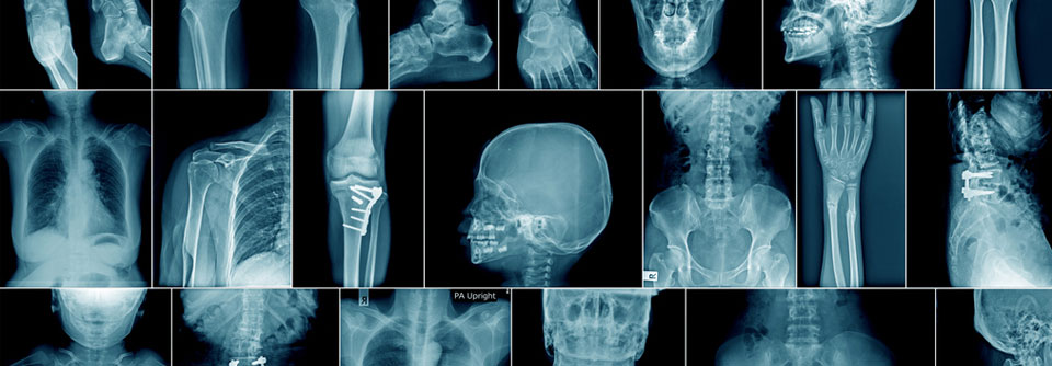 Für die Beurteilung von Röntgenbildern, die von anderen Medizinern angefertigt wurden, bekommen D-Ärzte künftig mehr Geld. 