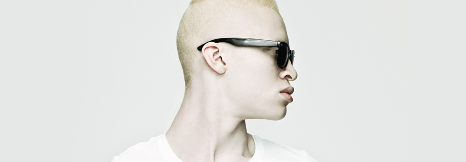 Albinismus äußert sich nicht nur in der Hypopigmentierung – häufig treten auch ophthalmologische Anomalien und Hörschäden auf.