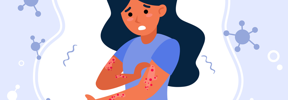 UCB gibt die Zulassung von Bimekizumab zur Behandlung von Erwachsenen mit mittelschwerer bis schwerer Plaque-Psoriasis durch die Europäische Kommission bekannt
Die Zulassung fußt auf den Phase-3-Studien BE READY, BE VIVID und BE SURE.