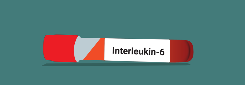 Interleukin-6-Inhibitoren wirken allein schnell und effektiv.