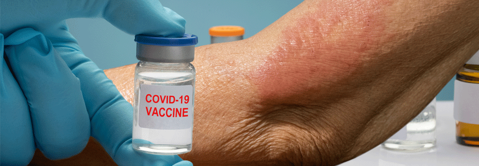 Der Ärzteverband Deutscher Allergologen hat einen Leitfaden zu Allergien auf COVID-19-Impfstoffe herausgegeben.