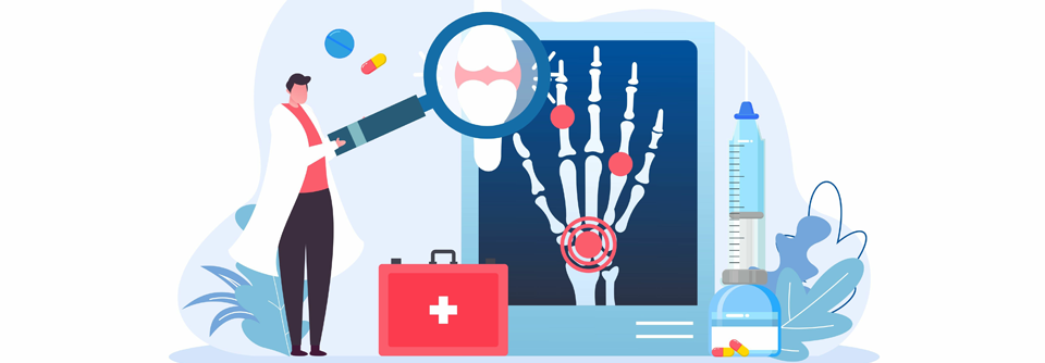 Etwa 1 % der Erwachsenen in Deutschland ist von rheumatoider Arthritis betroffen.