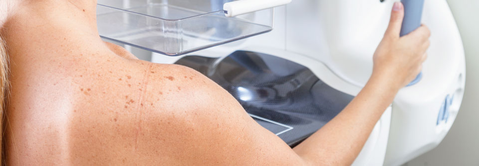 In Deutschland werden bislang nur Frauen von 50 bis 69 Jahren zum Mammographie-Screening eingeladen.