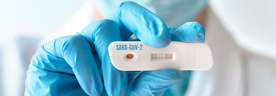 Auch noch mehr als einen Monat nach der Infektion zeigte der PCR-Test ein positives Ergebnis.