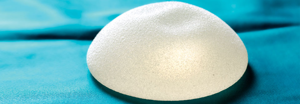 Brustchirurgie: Forscher fordern den Verzicht auf Silikonimplantate
Undichte Brustimplantate: Fast immer lassen sich auch außerhalb der Kapsel Silikonpartikel nachweisen.