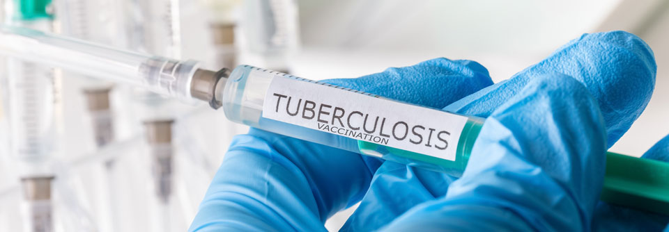 Wer als Junge gegen Tuberkulose geimpft wurde, hat auch gegen COVID-19 einen gewissen Schutz.