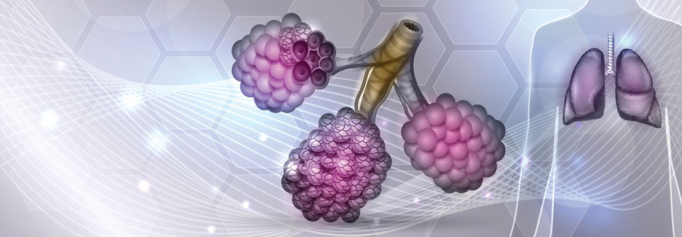 Ob eine COPD emphysemdominiert ist oder nicht, kann auf unterschiedlichem Wege herausgefunden werden.