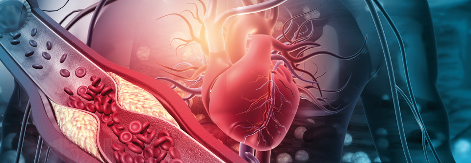 Der GLP1-RA half besonders bei Personen mit kardiovaskulären Risikofaktoren.