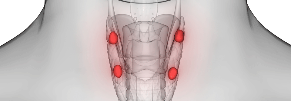 In 95–99 % der Fälle gelingt durch die Parathyreoidektomie eine Heilung des Hyperparathyreoidismus.