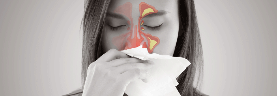 22,4 % der Untersuchten, die im Fragebogen allergische Symptome angegeben hatten, berichteten auch über eine Sinusitis. (Agenturfoto)