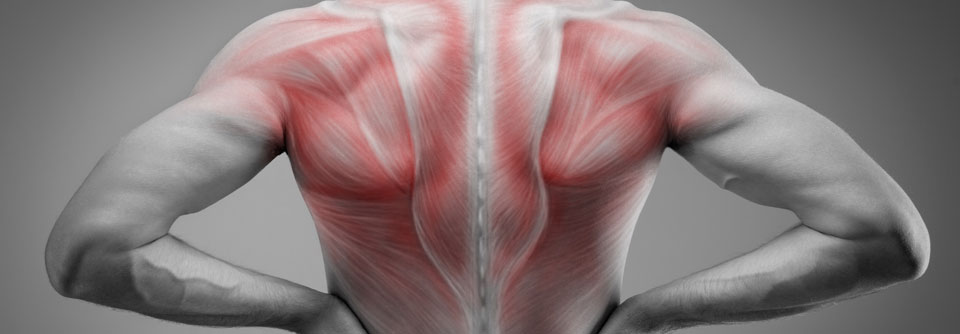Die durch Statine verursachten muskulären Schmerzen treten meist zunächst proximal auf.