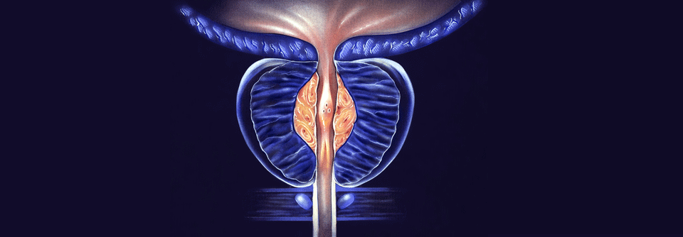 Die Studien PROpel, PRESIDE, CYPIDES und ARDENT treiben Entwicklungen in der Erstlinientherapie des kastrationsresistenten Prostatakarzinoms voran.