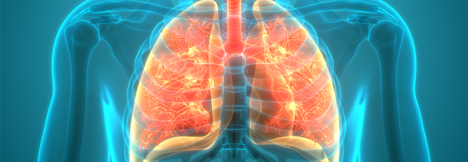 Das ACO ist in der Praxis selten eine primäre Diagnose, sondern wird meist festgestellt bei Patienten, die bereits an Asthma oder COPD leiden.