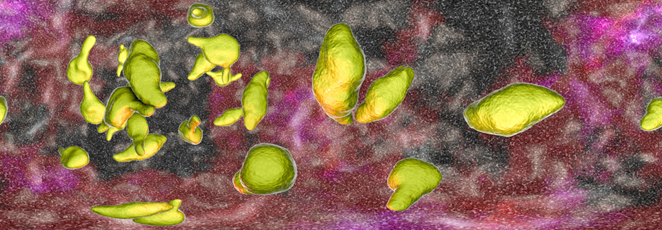 Mycoplasma genitalium: Unruhestifter in Urether, Zervix oder Becken Mycoplasma genitalium besitzt keine Zellwand und spricht daher z.B. nicht auf Betalaktamantibiotika an.
