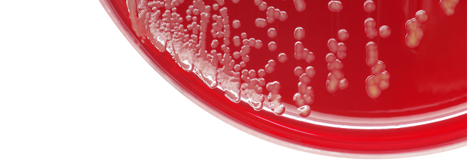 Staphylococcus aureus lässt sich auf der Haut von fast jedem Neurodermitispatienten nachweisen. 