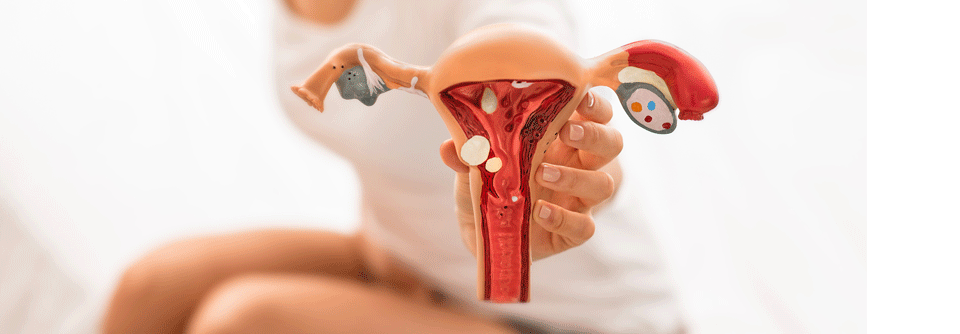 Vorzeitige Wehen sind bei Endometriose häufiger.