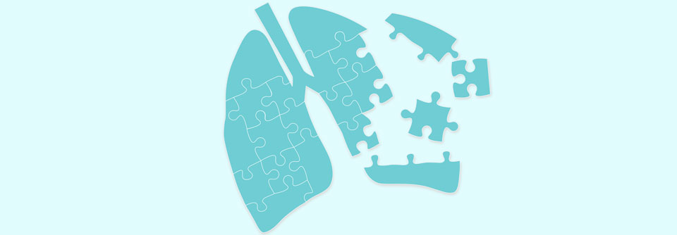 Um die Diagnose Hypersensitivitäts­pneumonitis stellen zu können, muss man viele Puzzleteilchen zusammensetzen.